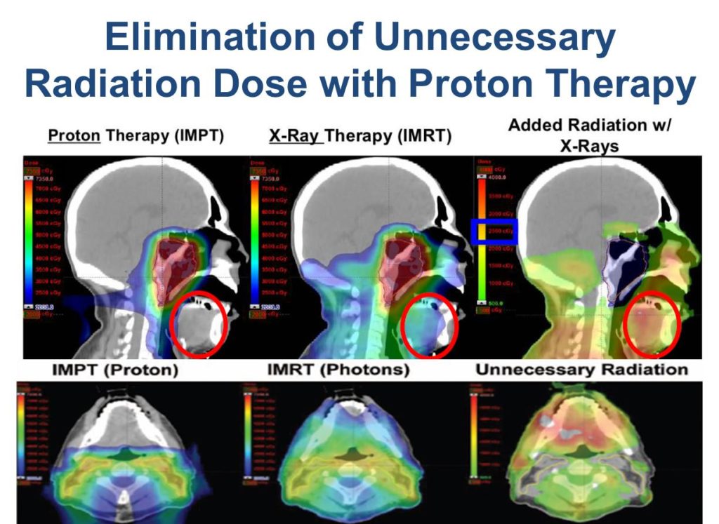 Inova Center for Advanced Radiation Oncology and Proton Therapy
